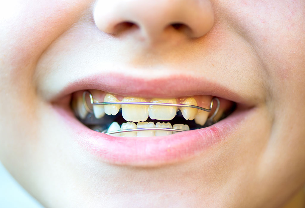 Dentista infantil en Indautxu